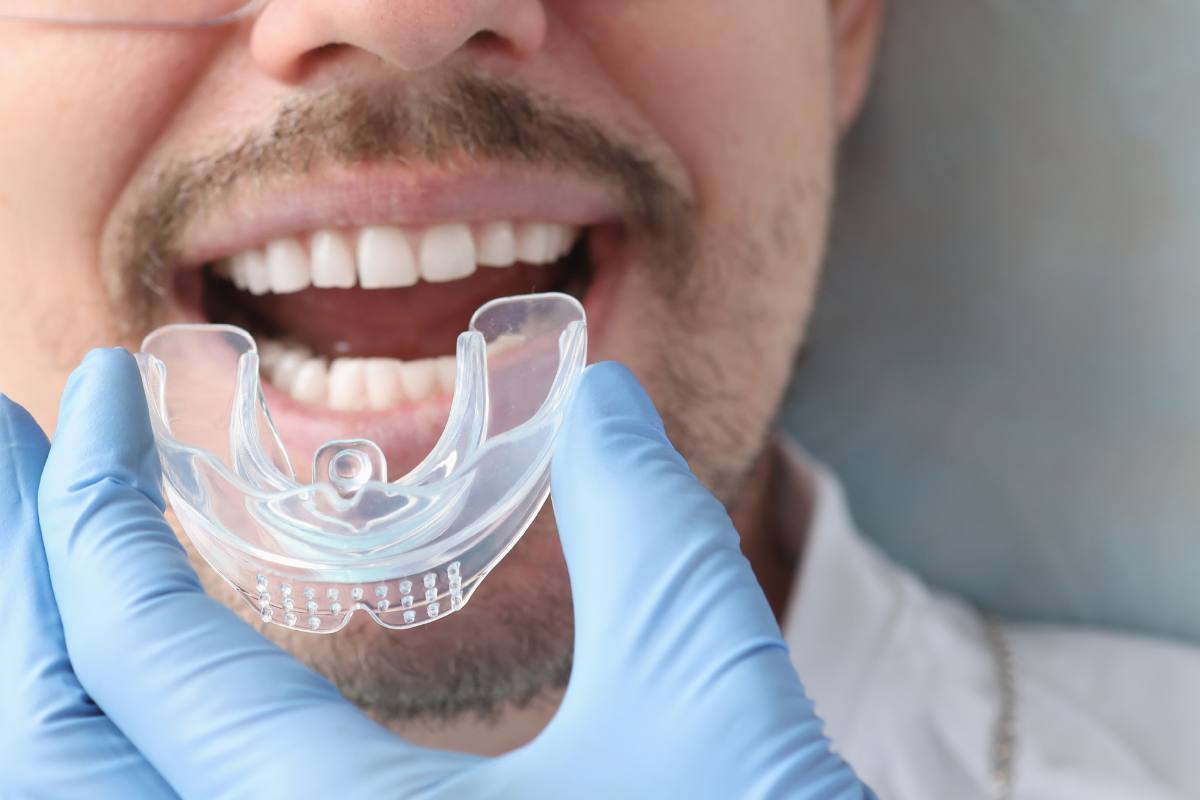 Gráfico que muestra las diferencias entre oclusión y bruxismo en odontología.